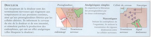 at01douleur.JPG